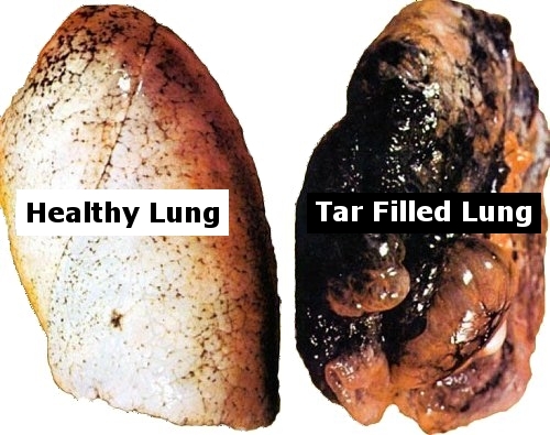 your lungs after smoking